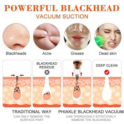 6 in 1 multifunction blackhead remover